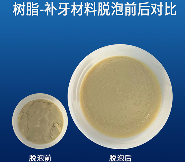 补牙材料真空脱泡 补牙材料真空脱泡